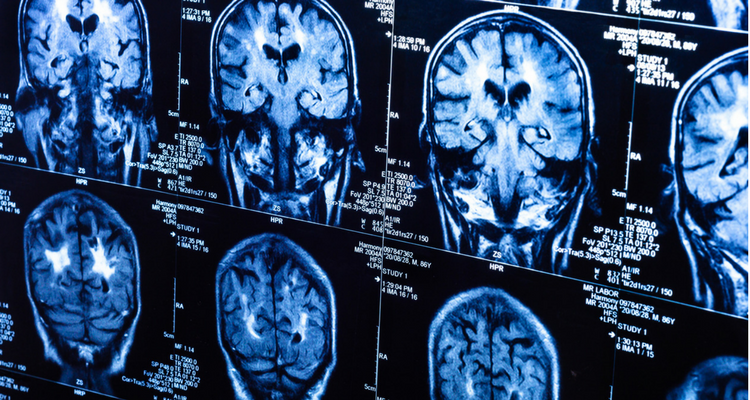 brain